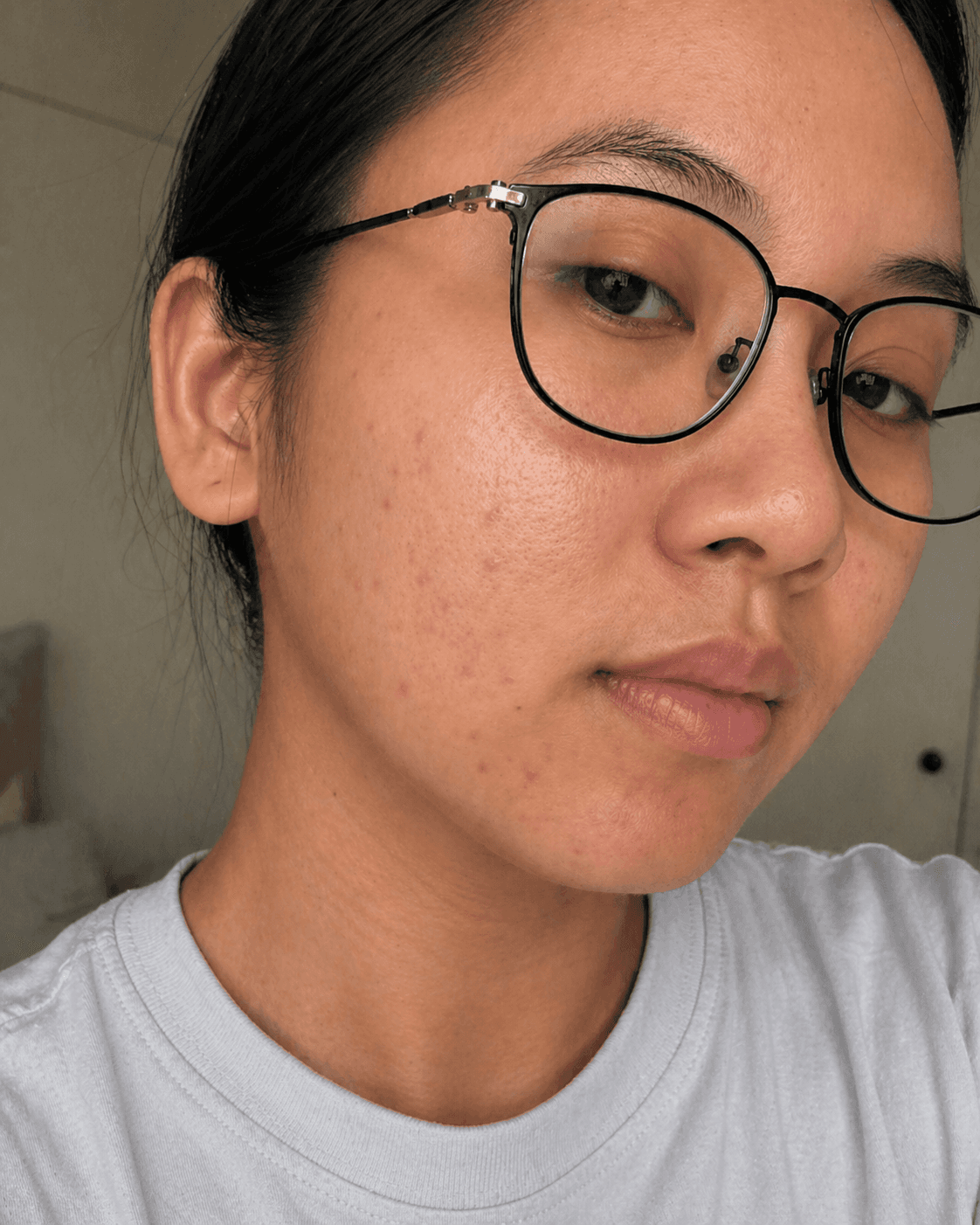 Customer after using Oui Era Power Patch