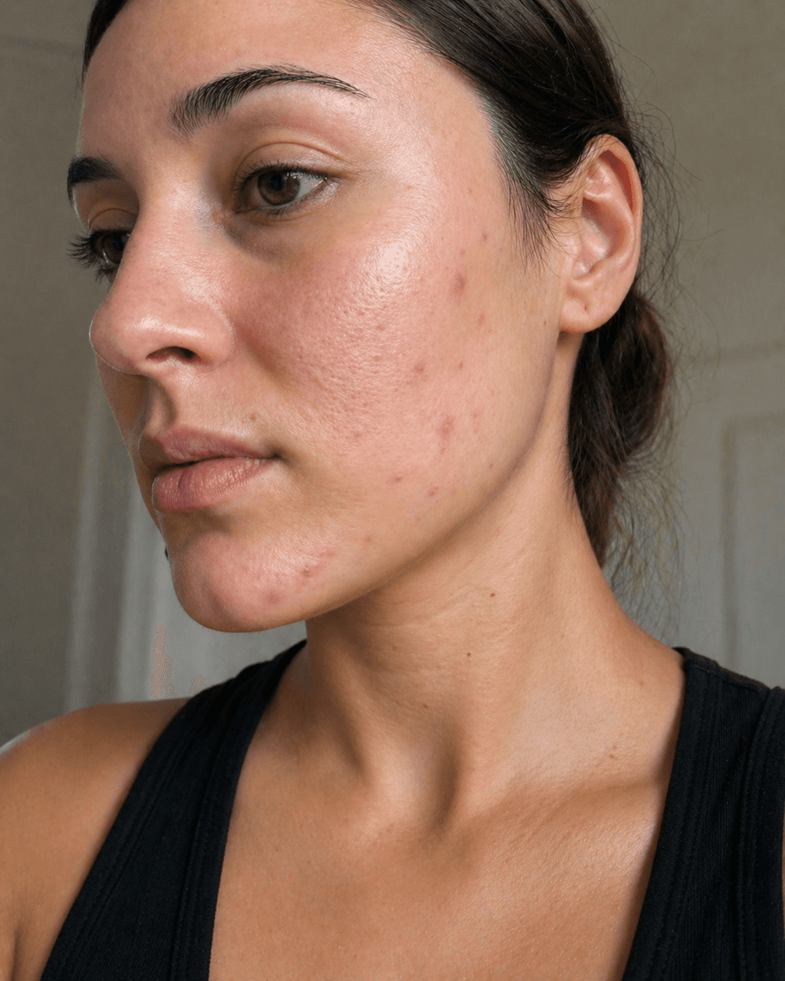 Customer after using Oui Era Power Patch