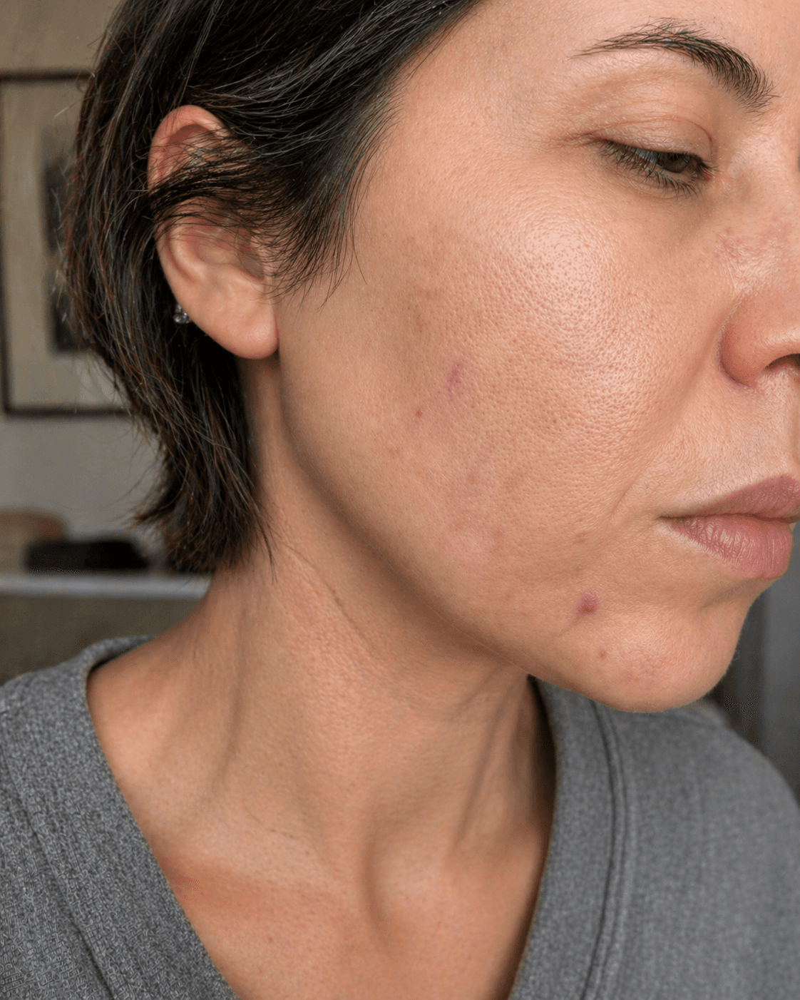 Customer after using Oui Era Power Patch
