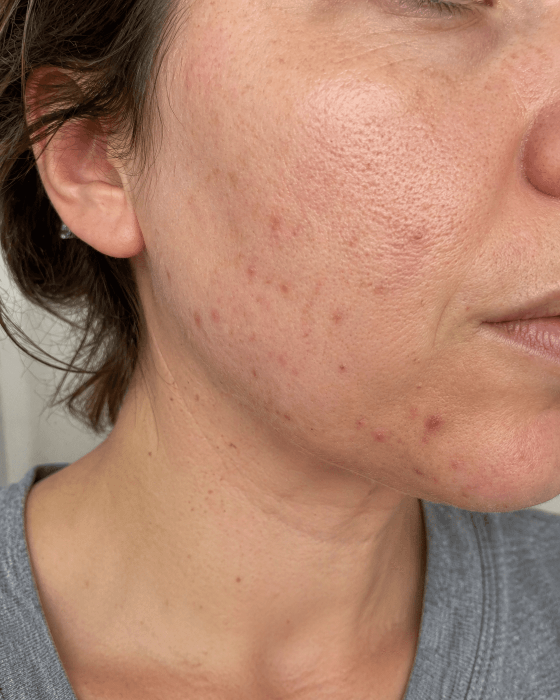 Customer before using Oui Era Power Patch