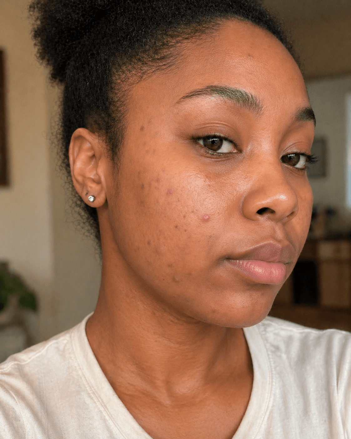 Customer after using Oui Era Power Patch