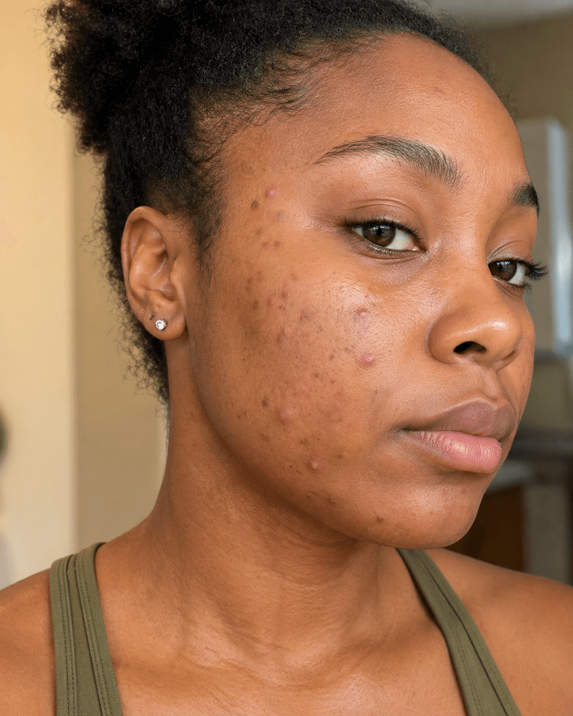 Customer before using Oui Era Power Patch