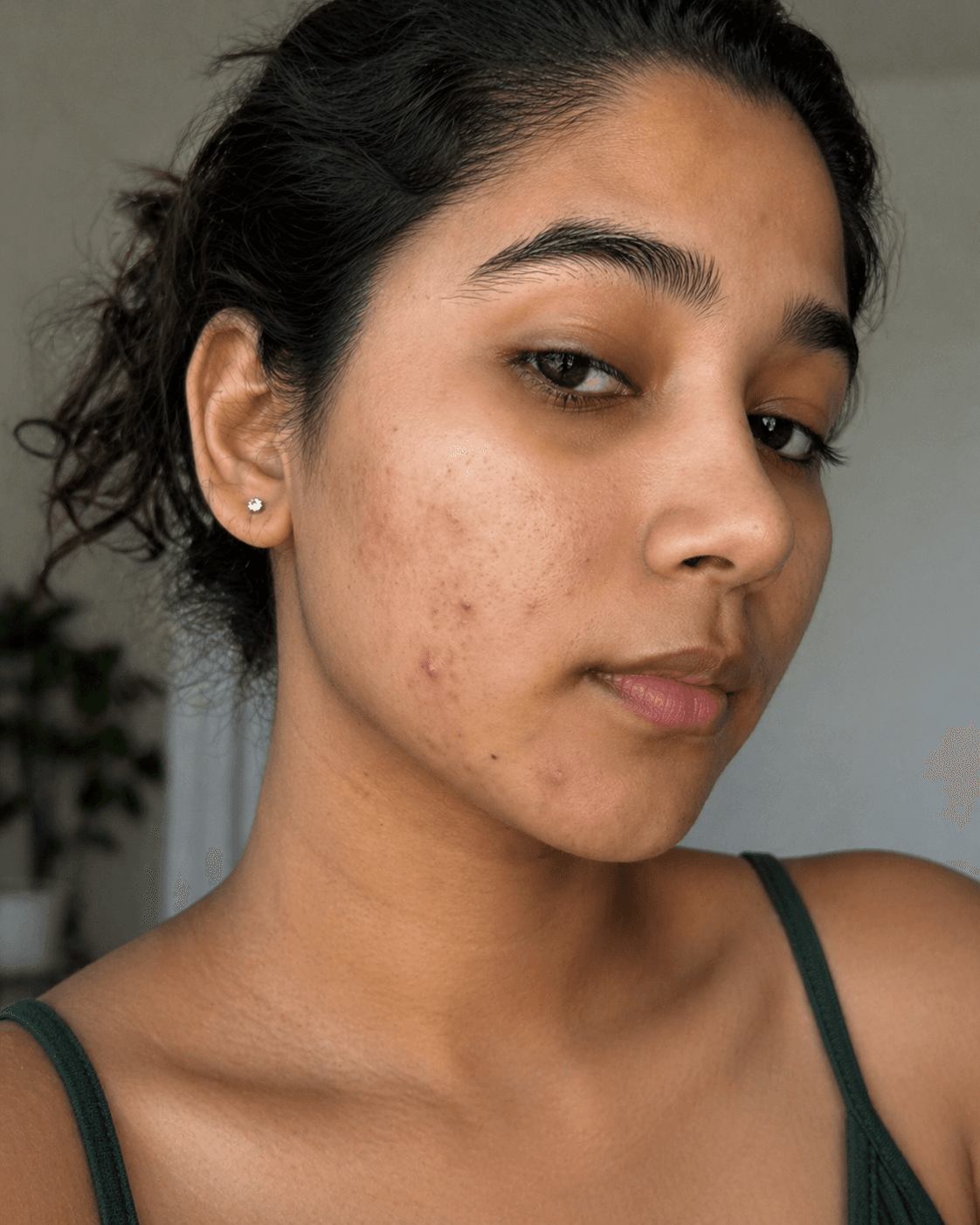 Customer after using Oui Era Power Patch