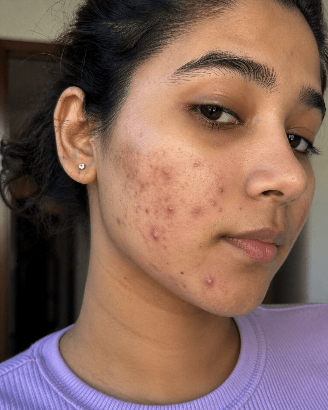 Customer before using Oui Era Power Patch