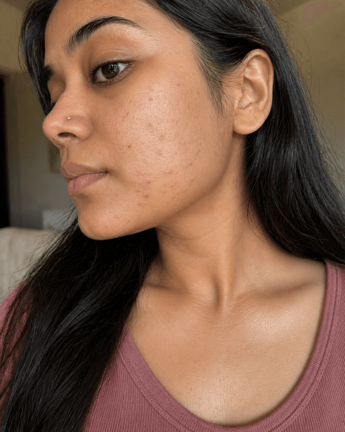 Customer after using Oui Era Power Patch