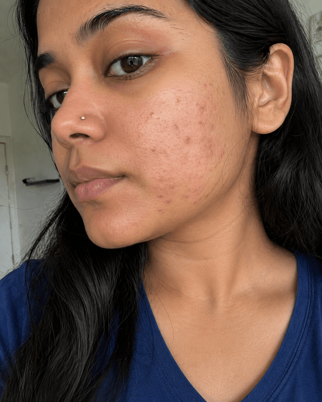 Customer before using Oui Era Power Patch