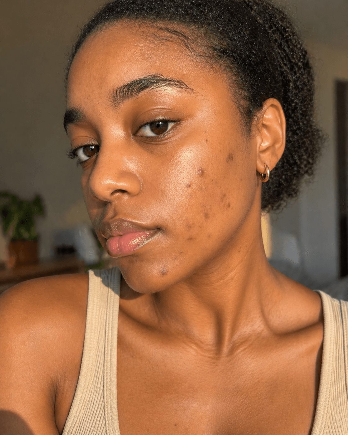 Customer after using Oui Era Power Patch