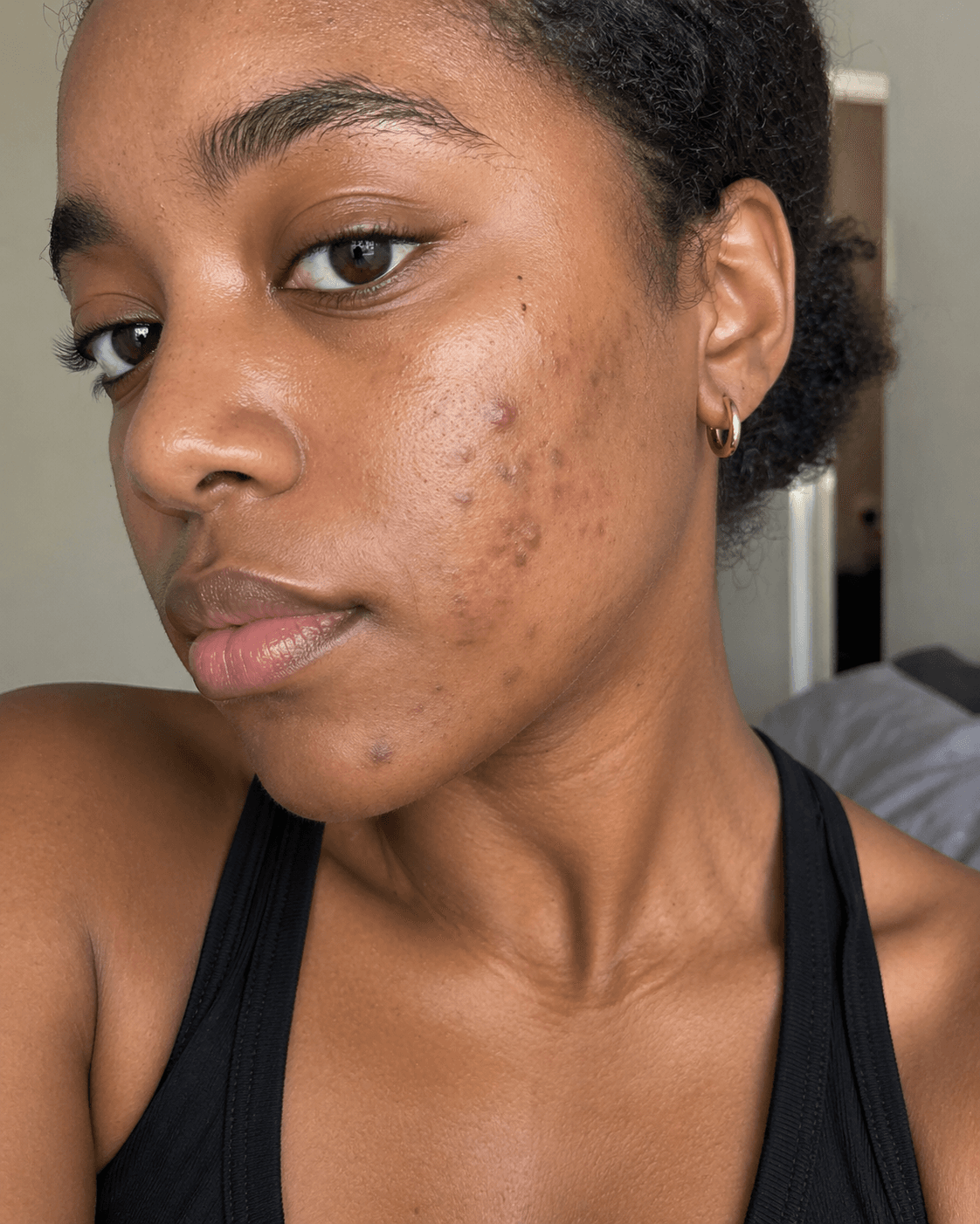 Customer before using Oui Era Power Patch